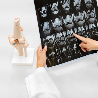 A person in a white coat pointing at a sheet of knee scans, beside a model of a knee joint on a white table