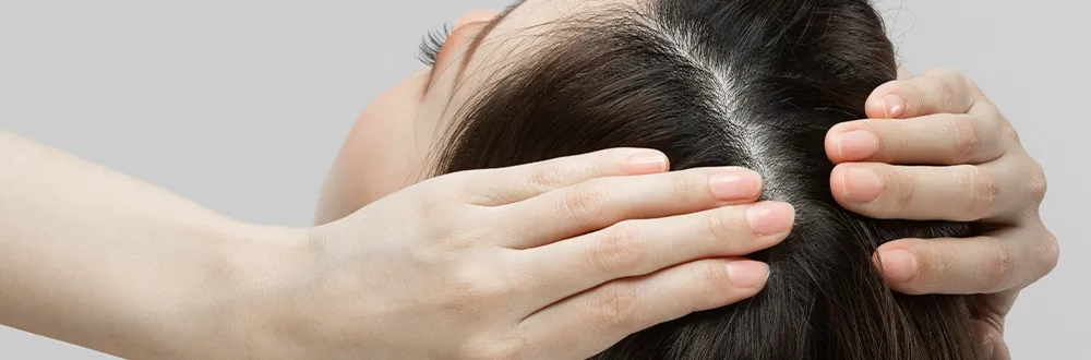 Two hands parting long dark hair to show the scalp along the parting, seen from above